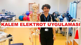 KALEM ELEKTROT UYGULAMASI [upl. by Anehta]