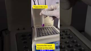 wait for end for triglycerides test tryglycerides lipidprofile lipidscience themltnk [upl. by Ralfston]