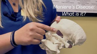 Vertigo Vs Menieres Disease Chiropractor in St Charles IL [upl. by Kissiah]