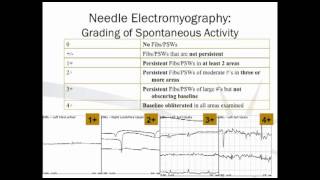 Electrodiagnostic Testing [upl. by Ettesoj]