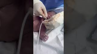 Help this newborn clean the amniotic fluid in his mouth [upl. by Nnylirehs]