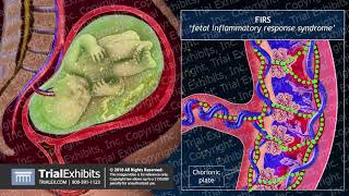 Progression of Chorioamnionitis and its Effects on the Fetal Brain [upl. by Greenwell]