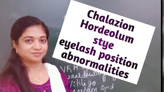 Inflammation of glands of eyelids chalazionHordeolumTrichiasisDischiasisTrichomegaly [upl. by Jaclyn]