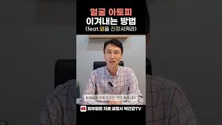 얼굴 아토피를 위한 3가지 방법 공개🌟l 한의사 박건 [upl. by Beard]