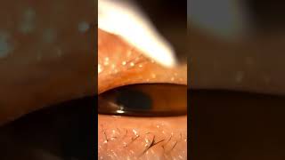 Unblocking oil glands in your eyelid with eyelid massage [upl. by Ardnola]