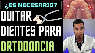 EXTRAER DIENTES para una ORTODONCIA  ¿Te han dicho de QUITAR los PREMOLARES ¿Es necesario [upl. by Lemuela]