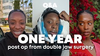 JAW SURGERY QampA ONE YEAR POST OP FROM DOUBLE JAW SURGERY emotional [upl. by Kiri]