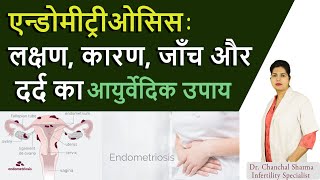 Endometriosis Symptoms causes Pain relief Diagnosis and Ayurvedic Treatment  Aasha Ayurveda [upl. by Rochkind]