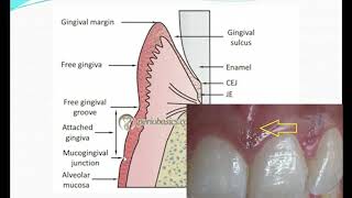 Normal Periodontium Part I Development of periodontium and its macroscopic features [upl. by Tfat]