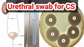 urethral swab for culture and sensitivity CS test urduhindi [upl. by Lowe]