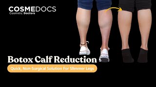 Botox Calf Reduction Quick NonSurgical Solution for Slimmer Legs [upl. by Gelya660]