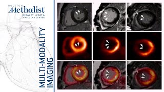 Heart Failure I Evaluating Myocardial Viability Zoghbi MD AlMallah MD Shah MD January 5 2021 [upl. by Smaj]