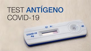 Test Antígeno COVID19 Clínica CEMTRO [upl. by Adnauqahs855]