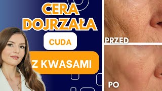 CERA DOJRZAĹA PielÄ™gnacja Antiaging  Najlepsze Kosmetyki z Kwasami [upl. by Priscella249]