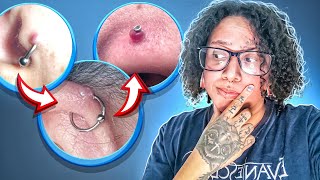 PRESCISA TIRAR O PIERCING PARA TRATAR O GRANULOMA [upl. by Angus]