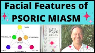 Psoric Miasm characteristics homeopathy facial features of psoric miasm in english homeopathy class [upl. by Leanora]