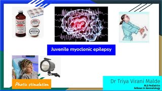 Juvenile Myoclonic Epilepsy with EEG  Neet PG  FMG  INI CET [upl. by Akoek]