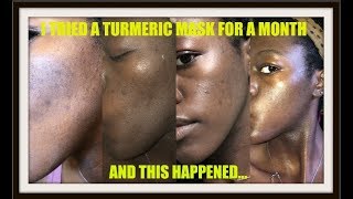 I TRIED A TURMERIC MASK EVERYDAY FOR A MONTH [upl. by Hollinger]