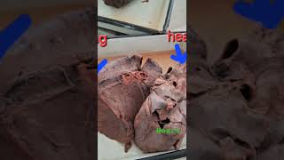 Anatomy Dissection doctor mbbs neet motivation goals doctor [upl. by Jillie919]