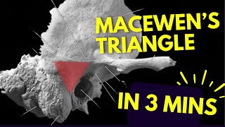 Macewens Triangle 📐  In THREE MINUTES [upl. by Nonah]