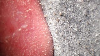 Pore Strips removal close up Blackheads removal [upl. by Rorry]