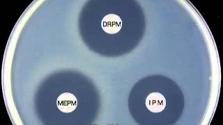 CARBAPENEMS  Doripenem Mechanism of Action [upl. by Anilys87]