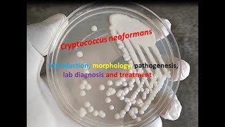 Cryptococcus neoformans Introduction morphology pathogenesis lab diagnosis and treatment [upl. by Nassah]