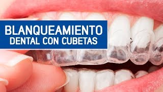 Blanqueamiento por cubetas  Odontoespecialistas [upl. by Maribeth595]