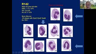 MDSR 2024 Morphology [upl. by Lebasy986]