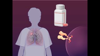 Adjuvant Osimertinib and Advanced EGFRMutated NSCLC  NEJM [upl. by Feune]