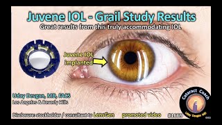 CataractCoach™ 1669 Juvene accommodating IOL  LensGen Grail Study Results [upl. by Htiduy]