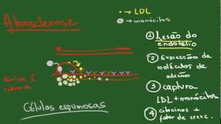 Degenerações Parte 1 Acúmulos Intracelulares  Resumo  Patologia [upl. by Eenoj182]