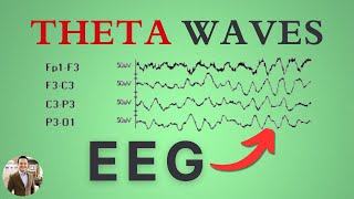 Theta Waves on the EEG [upl. by Yesnikcm291]