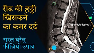 रीढ की हड्डी खिसकने का कमर दर्द सरल घरेलू फीज़ियो उपाय  Self physio for Spondylolisthesis backpain [upl. by Thaine]