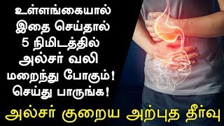 அல்சர் குணமாக வீட்டு வைத்தியம்  Ulcer Treatment in Tamil Ulcer Symptoms in Tamil Tamil Health Tips [upl. by Karwan99]