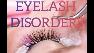 Eyelash disorders  Trichiasis Distichiasis Madarosis Trichomegaly Poliosis [upl. by Mattheus]