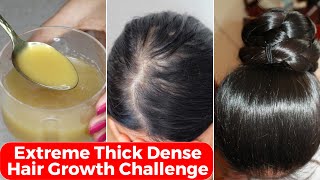 30 Days Extreme Thick Hair Growth ChallengeIncrease Hair Density amp thicknessपतले बालों को घना करे [upl. by Sherurd]