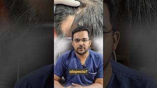 Is it possible to perform a hair transplant for scarring alopecia  Dr Alok Sahoo  alloroots [upl. by Okikuy58]