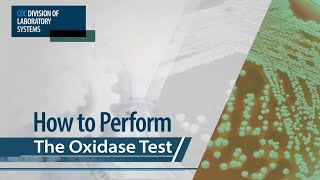 How to Perform the Oxidase Test [upl. by Enajharas]