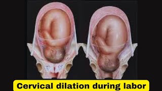 Cervical dilation how to check for laborhow to check if your cervix is dilated [upl. by Drye297]