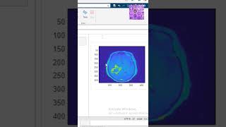 DICOM Info viewer MATLAB shorts matlabprojects viral [upl. by Htiaf]