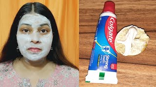 Colgate toothpaste for face whitening  Lemon and colgate  Colgate Face Par Lagane Se Kya Hota Hai [upl. by Ahsekahs761]