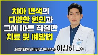 치아 변색의 다양한 원인과 그에 따른 적절한 치료 및 예방법 [upl. by Brodench]