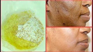 NATURAL EXFOLIATING FACIAL SCRUB FOR CLEARING BLACKHEADS DARK SPOTS DULL DRY SKIN GET CLEAR SKIN [upl. by Seiter553]