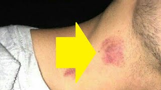 how to give someone a hickey fast for beginners [upl. by Nyleahcim]