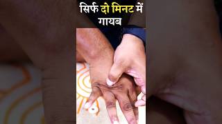 powerful massage for sciatica youtubeshorts shorts shortsfeed apakahealthguru sciatica [upl. by Ekal]