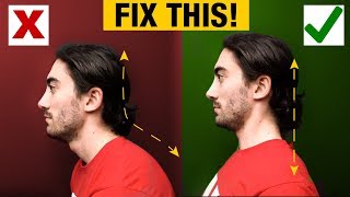 How to Fix Forward Head  Slumped Posture PERMANENTLY [upl. by Patnode146]