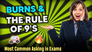 Burns amp Rule of 9s Review for Nurses Burn Patients [upl. by Gallenz]