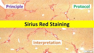 Sirius Red Staining Made Easy Beginners Overview  Principle Protocol amp Interpretation Tips [upl. by Cresida44]