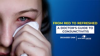 Conjunctivitis Or Common Eye Flu in Hindi Symptoms Causes And Treatment  आई फ्लू का इलाज [upl. by Rebmak575]